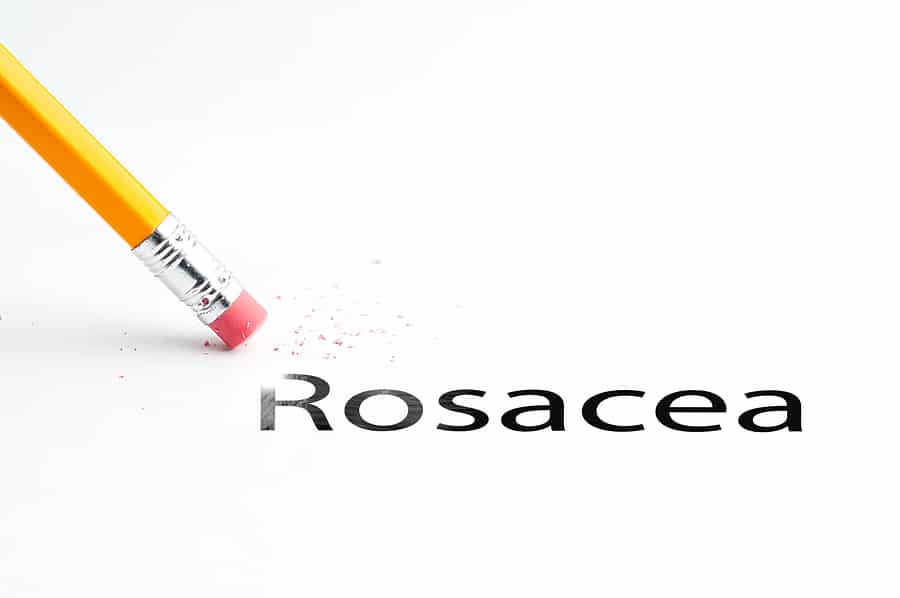 Rosacea Awareness Month: FAQs About Rosacea in Seniors